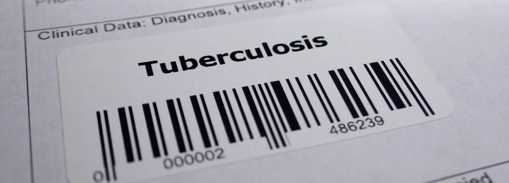 Tuberculosis test | People and Culture | Queen's University Belfast